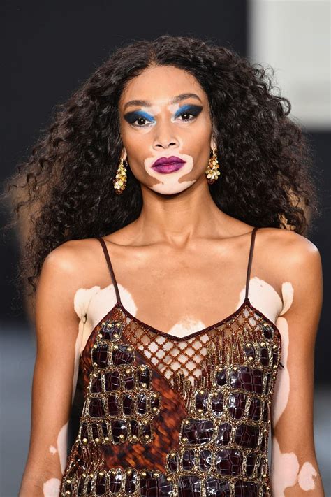 Winnie Harlow